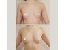 【離れ乳にお悩み】全身オールハンド施術でお悩み改善体験☆