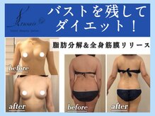 ビテュセスリー はなみずき店(美tusais3)
