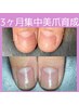 コンプレックス爪とサヨナラ★「自爪育成ケアコース」88000円