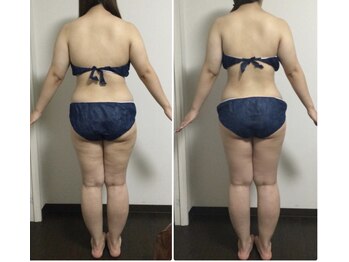 エステティックサロン ローブ(ESTHETIC SALON LAUB)の写真/最新機器6種+熟練ハンドで一気に大幅サイズ減⇒《人気No.1!オーダーメイド★ダイエットコース120分¥6,980》