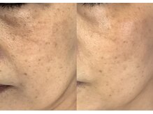 モガナ(mogana)/60代・ご来店半年間での変化