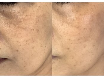 モガナ(mogana)/60代・ご来店半年間での変化