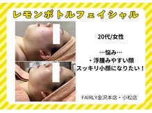 フェアリー 小松店/レモンボトル導入店♪