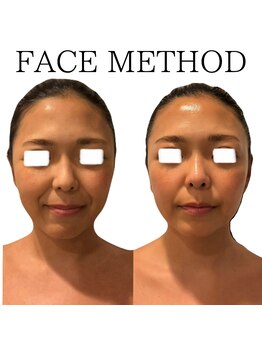 エミナル(EMINALu)/立体的な小顔