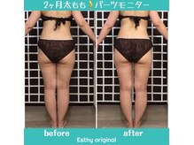 エスティービューティーサロン 南越谷店の雰囲気（【マイナス4キロ達成】痩身2ヶ月集中ス※クーポン配信中）