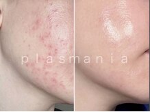 エフェクト 塚口店(effect)/Before After