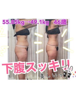 ボディエステティック アクアオーラ 富山店/下腹スッキリ！
