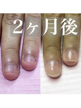 イリスネイル(IRIS NAIL)/