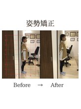 心斎橋長堀フェムテック整骨院/7姿勢矯正　骨格矯正と骨盤矯正