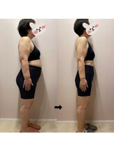 にこ鍼灸治療院/68歳　5ヶ月で25kg達成。