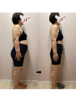 にこ鍼灸治療院/68歳　5ヶ月で25kg達成。