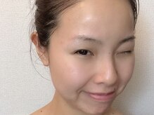 フォー(For...)/毛穴レスな陶器肌へ