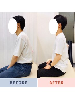 ナオル整体 三鷹院(NAORU整体)/20代男性施術事例【猫背姿勢】