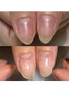 いじり癖がある爪も綺麗に育成