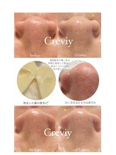クレヴィー(Creviy)/毛穴洗浄＆ハーブ＆鼻のwax脱毛