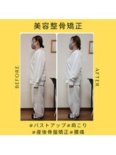 クローバー(Clover)/お客様before/after