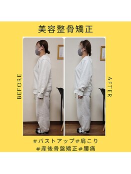 クローバー(Clover)/お客様before/after