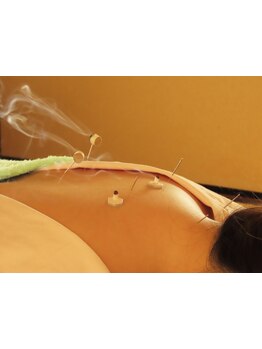 首・肩のつらさを改善したい