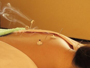 よもぎ堂 飯田橋の写真/【首肩こり/腰痛/慢性的な辛さにお悩みの方に】指圧マッサージは緩急をつけてほぐし、芯からコリを改善◎