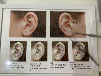 アニュームーン 上本町店(a New Moon)/耳ツボジュエリー
