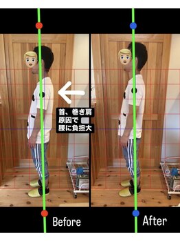 はまもと整骨院/整体・姿勢改善