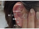 耳ツボジュエリー　