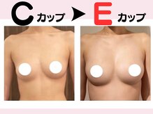 リリ(RILI)/【バストアップ・バストケア】