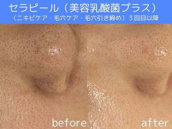 サロン ウーカ(salon WOOCA)/セラピール