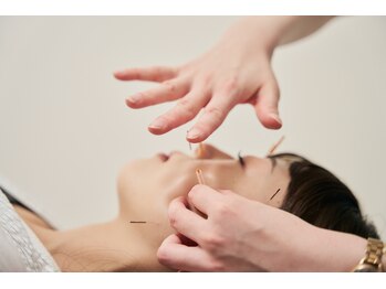 ハリナチュレ 新宿店/エラ張り特化美容鍼