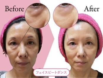 クリニカルエステ イーズ 広島祇園店/顔筋活☆フェイスビートダンス