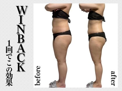 ララナ バイ カノア(LALANA by kanoa)の写真