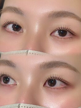 エノイ(enoi)/Las lift