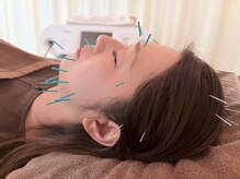 茶ノ木鍼灸整骨院の雰囲気（美容鍼 【Cosmetic Acupuncture】）
