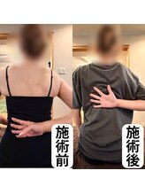 鍼灸整骨院ゼット(Z)&nbsp;首 肩コリ 改善整体