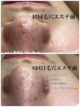 プラスエム(+M)/別人級！毛穴美人