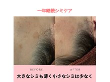 シミケアお写真。お写真ありがとうございました。