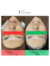 リノレリチア 心斎橋 新町店/