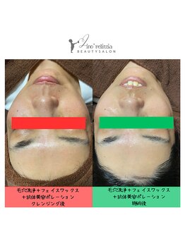 リノレリチア 心斎橋 新町店/