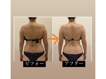 TMサロン 赤坂/わき肉の老廃物促しスッキリ