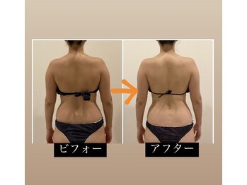 TMサロン 赤坂/わき肉の老廃物促しスッキリ