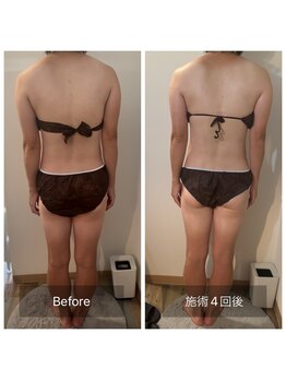 フィエルテ 甲斐敷島(FIERTE)/お客様 Before After