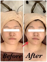 スペチアーレ 夙川/不動の人気、小顔ハイリフ無制限