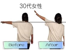 ビールーム 赤羽店(B-ROOM)/肩こりの悩み30代女性（左）