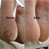 ソムネイル(Som Nail)