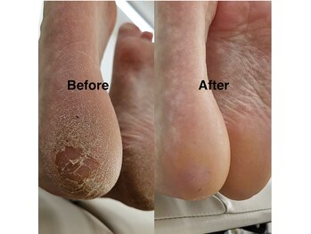 ソムネイル(Som Nail)