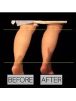 カモミール/足のむくみが気になる方に