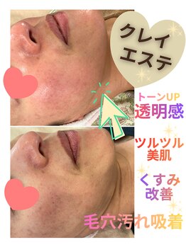 サロンド美美(Salon de vivi)/美白フェイシャルトリートメント