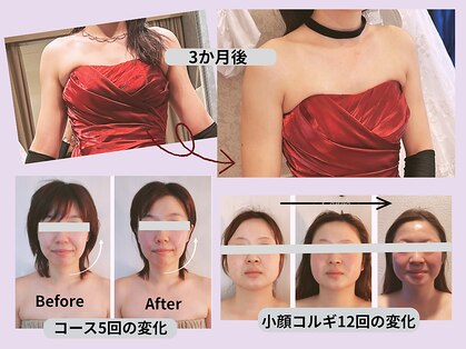 フォーリーフ(4/Leaf)の写真