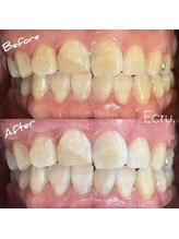 エクリュ(Ecru)/Before→After