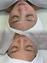 メルリー(Meruly)/階数を重ねる毎に綺麗なお肌へ！